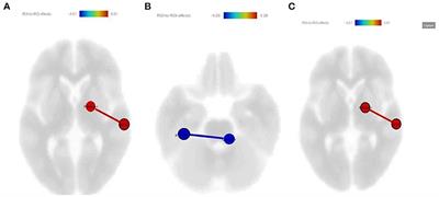 A Treatment-Response Comparison Study of Resting-State Functional Magnetic Resonance Imaging Between Standard Treatment of SSRI and Standard Treatment of SSRI Plus Non-dominant Hand-Writing Task in Patients With Major Depressive Disorder